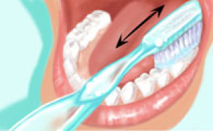 Orthodontie et hygiène bucco-dentaire Rosny sous bois